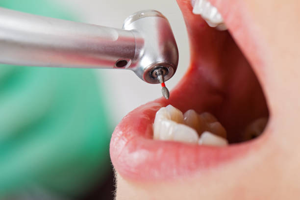 Best Pediatric Emergency Dentist in Oglethorpe, GA